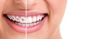 Beautiful white teeth. Marketing your dental practice requires among other things good reputation and a good dental logo